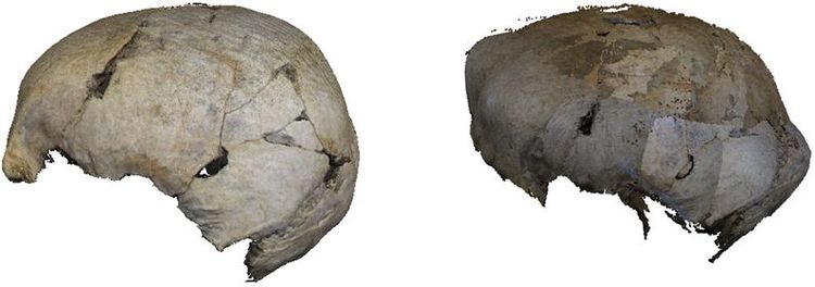screenshot comparing the reconstruction of a cranium with correct calibration on the left and incorrect calibration on the right