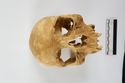 Thumbnail of Human skull BWL6_0008