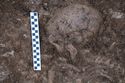 Thumbnail of Post-excavation shot of the skull of burial 2, SK033 (0.2m scale)