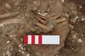Thumbnail of Photo 006467 Skeleton 605347 left hand