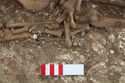 Thumbnail of Photo 006569 Skeleton 605282 right hand