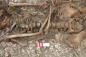 Thumbnail of Photo 006573 Skeleton 605282 Iron point in vertebrae spine