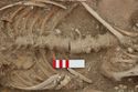 Thumbnail of Photo 007837 Skeleton 605350 spine