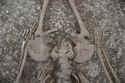 Thumbnail of Photo 009523 Skeleton 606041 pelvis detail