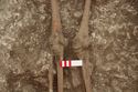 Thumbnail of Memorial Garden Photo 02141 Skeleton 608622 knees