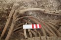 Thumbnail of Memorial Garden Photo 02143 Skeleton 608622 abdomen