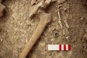 Thumbnail of Memorial Garden Photo 02427 Skeleton 608659 left hand and ring