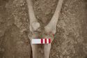 Thumbnail of Memorial Garden Photo 04018 Skeleton 608707 knees