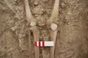 Thumbnail of Memorial Garden Photo 04963 Skeleton 608743 knees