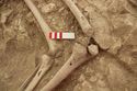 Thumbnail of Memorial Garden Photo 05479 Skeleton 608749 knees