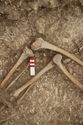 Thumbnail of Memorial Garden Photo 06165 Skeleton 608759 knees