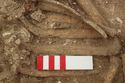 Thumbnail of Photo 10391 Skeleton 606044 pathologies