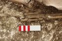 Thumbnail of Photo 12222 Skeleton 606251 left hand