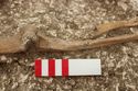 Thumbnail of Photo 12224 Skeleton 606251 right arm pathologies