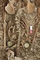 Thumbnail of Photo 12227 Skeleton 606251 abdomen