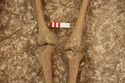 Thumbnail of Photo 12649 Skeleton 605723 knees
