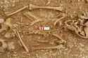 Thumbnail of Photo 13727 Skeleton 605389 spine