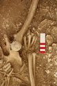Thumbnail of Photo 13731 Skeleton 605389 right hand