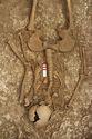 Thumbnail of Photo 14077 Skeleton 605395 abdomen