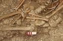 Thumbnail of Photo 15403 Skeleton 606982 abdomen
