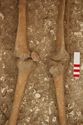 Thumbnail of Photo 15872 Skeleton 605413 knees
