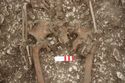 Thumbnail of Photo 17394 Skeleton 605276 knees