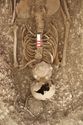 Thumbnail of Photo 18012 Skeleton 607408 shield boss and torso, overhead