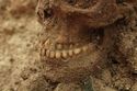 Thumbnail of Photo 18912 Skeleton 607279 skull, teeth detail 2