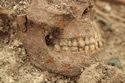 Thumbnail of Photo 18913 Skeleton 607279 skull, teeth detail 3