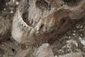Thumbnail of Photo 22476 Skeleton 605358 teeth