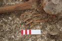Thumbnail of Photo 23080 Skeleton 605410 left hand