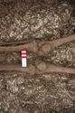 Thumbnail of Photo 29252 Skeleton 608604 knees