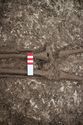 Thumbnail of Photo 30414 Skeleton 608612 knees