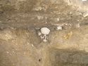 Thumbnail of Detail shot of human skull 