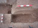 Thumbnail of Post-ex view of SB [1356] 