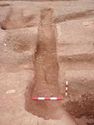 Thumbnail of Post-ex view of PT [1570] 