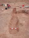 Thumbnail of Post-ex view of PT [1570] 