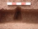 Thumbnail of Post-ex view of PT [1714] 
