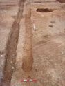 Thumbnail of Post-ex view of PT [1684] 