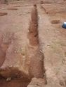 Thumbnail of Post-ex view of PT [1159] 