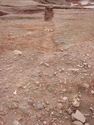 Thumbnail of Post-ex view of PT [1157] 