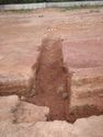 Thumbnail of Post-ex view of PT [1157] 
