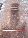 Thumbnail of Post-ex view of PT [2277] 