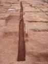Thumbnail of Post-ex view of PT [1521] 