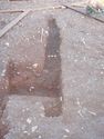 Thumbnail of Post-ex view of PT [2390] 