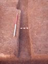 Thumbnail of Post-ex view of PT [1993] and [1714] 