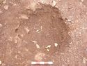 Thumbnail of Post-ex view of PH [2592] 