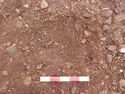 Thumbnail of Post-ex view of PH [2596] 