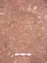 Thumbnail of Post-ex view of PH [2602] 