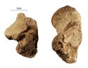 Thumbnail of Figure 6.10: Bainesse Cemetery: Skeleton 12731 (Grave 87), non-osseous coalition of left calcaneus and talus.